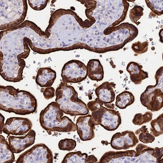 SREK1IP1 Antibody in Immunohistochemistry (IHC)