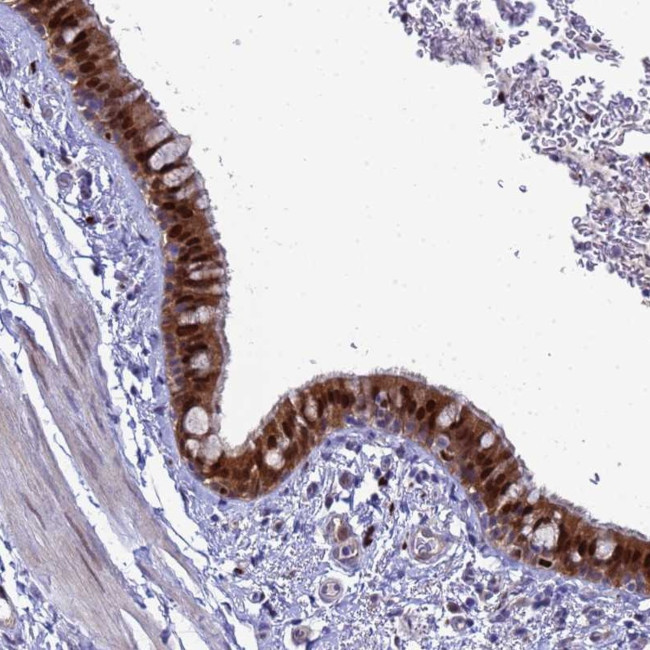 SLC25A37 Antibody in Immunohistochemistry (Paraffin) (IHC (P))