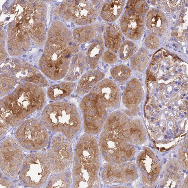 UBE2G1 Antibody in Immunohistochemistry (Paraffin) (IHC (P))