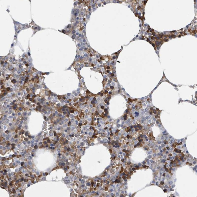 SEBOX Antibody in Immunohistochemistry (Paraffin) (IHC (P))