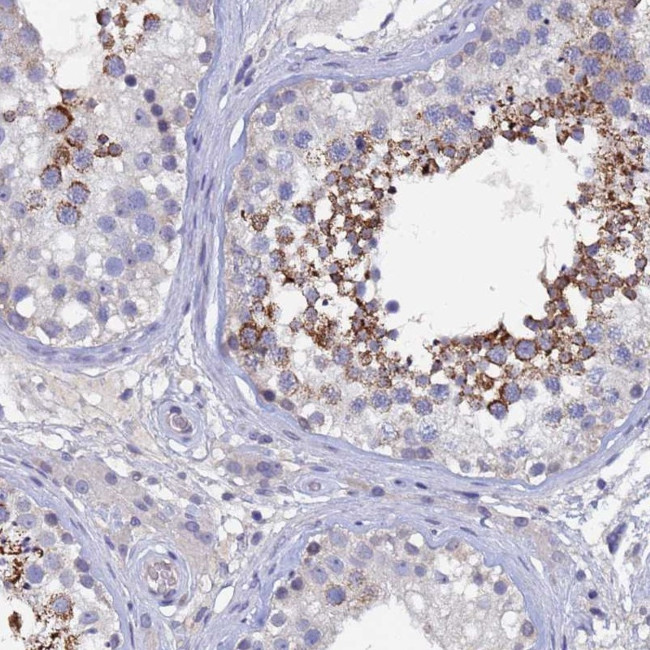 CCDC36 Antibody in Immunohistochemistry (Paraffin) (IHC (P))