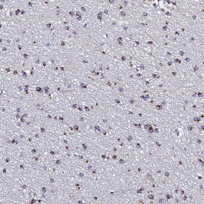 MEF2BNB Antibody in Immunohistochemistry (IHC)