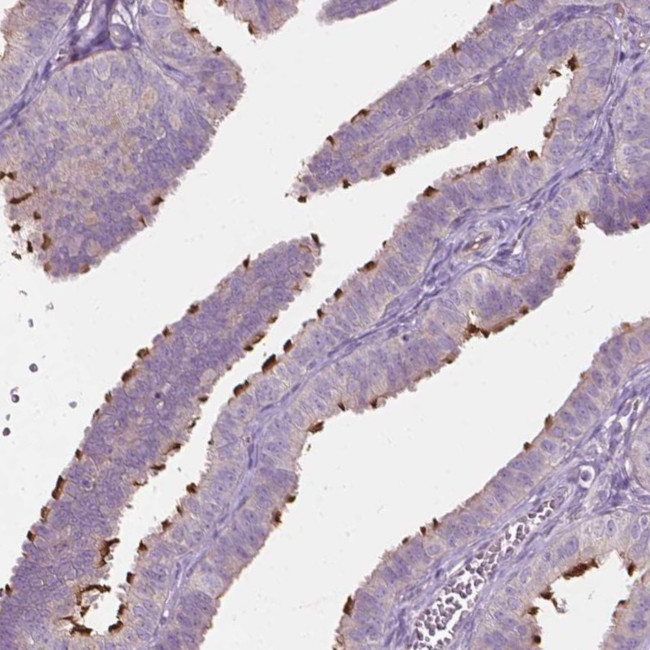 RIIAD1 Antibody in Immunohistochemistry (Paraffin) (IHC (P))