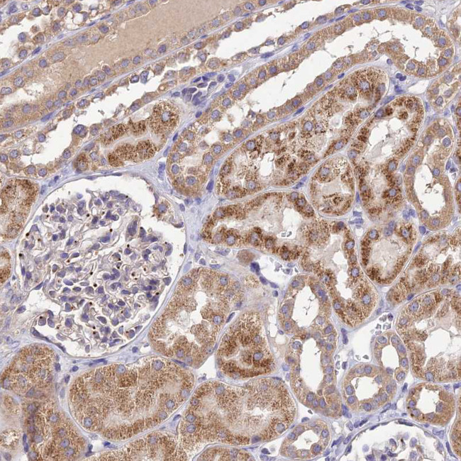 SDHD Antibody in Immunohistochemistry (Paraffin) (IHC (P))