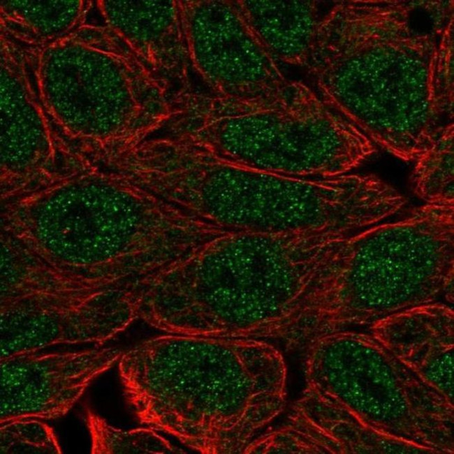 EVPLL Antibody in Immunocytochemistry (ICC/IF)