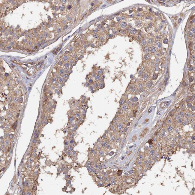SPANXN4 Antibody in Immunohistochemistry (Paraffin) (IHC (P))