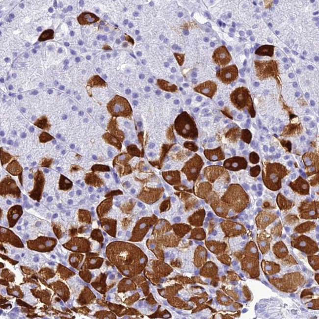 ZNF442 Antibody in Immunohistochemistry (Paraffin) (IHC (P))