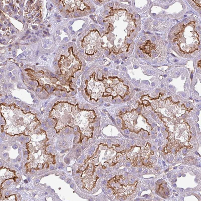 EME2 Antibody in Immunohistochemistry (Paraffin) (IHC (P))