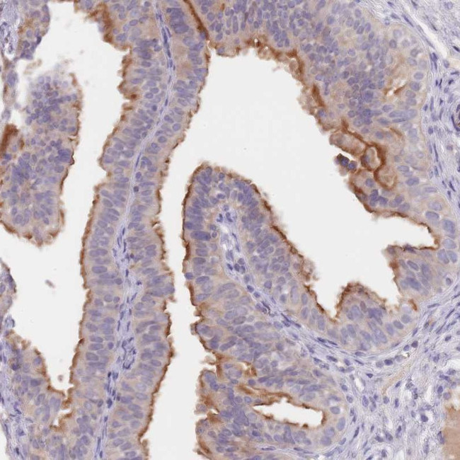 C1orf189 Antibody in Immunohistochemistry (Paraffin) (IHC (P))