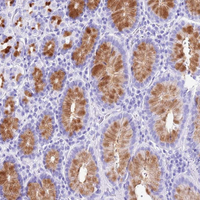 DCDC2B Antibody in Immunohistochemistry (Paraffin) (IHC (P))