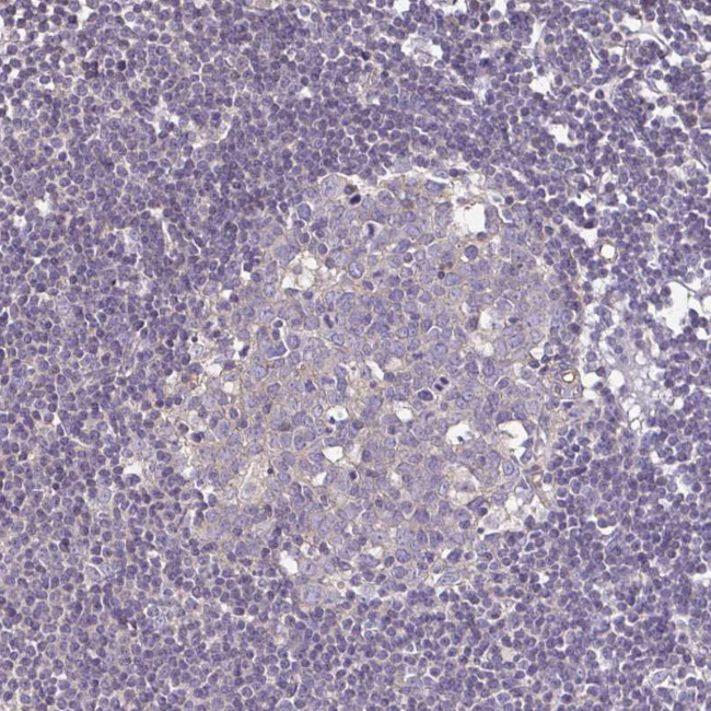 Desmoplakin Antibody in Immunohistochemistry (Paraffin) (IHC (P))