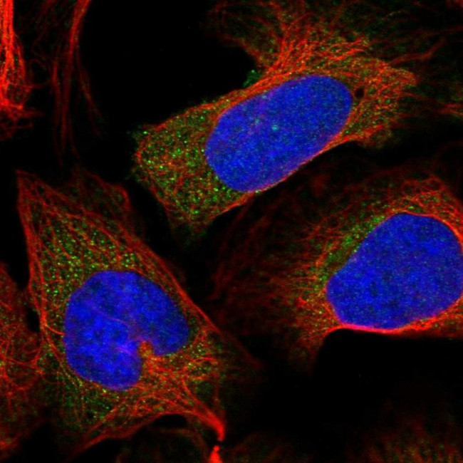 S100A16 Antibody in Immunocytochemistry (ICC/IF)