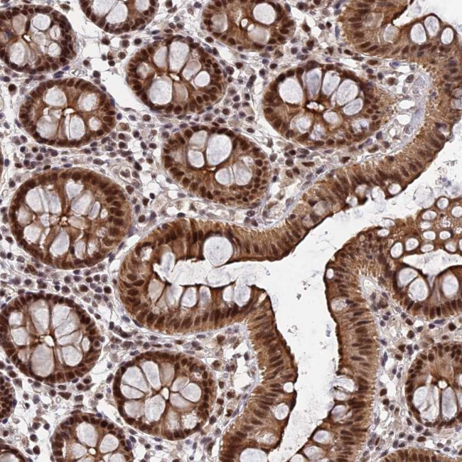 XPG Antibody in Immunohistochemistry (Paraffin) (IHC (P))