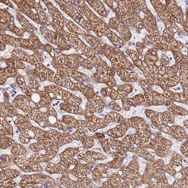 DCDC2C Antibody in Immunohistochemistry (Paraffin) (IHC (P))