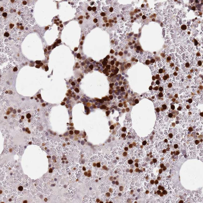 RESP18 Antibody in Immunohistochemistry (Paraffin) (IHC (P))