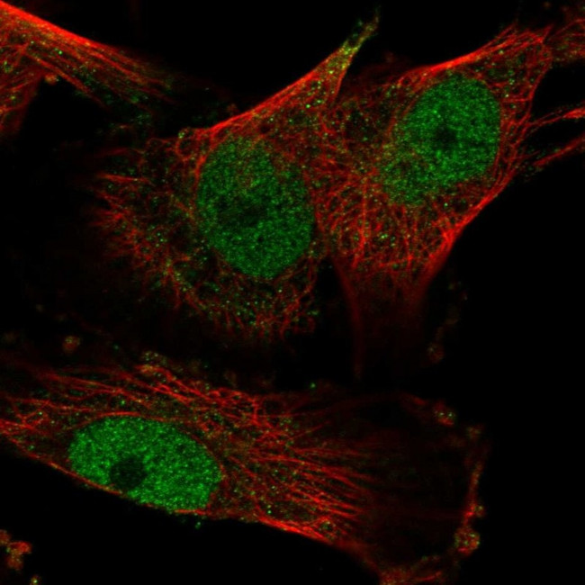 YEATS2 Antibody in Immunocytochemistry (ICC/IF)