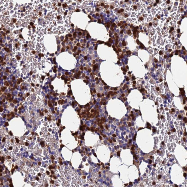 TUBAL3 Antibody in Immunohistochemistry (Paraffin) (IHC (P))