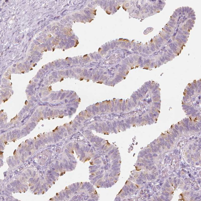 CFAP126 Antibody in Immunohistochemistry (Paraffin) (IHC (P))