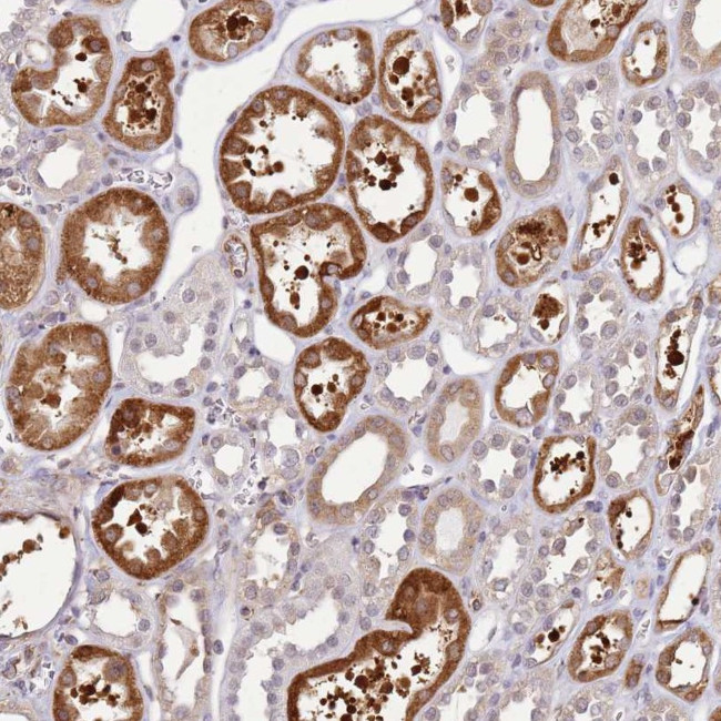 GABRE Antibody in Immunohistochemistry (Paraffin) (IHC (P))