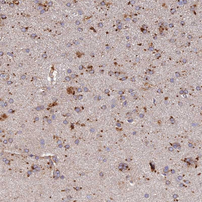 ARL8A Antibody in Immunohistochemistry (Paraffin) (IHC (P))