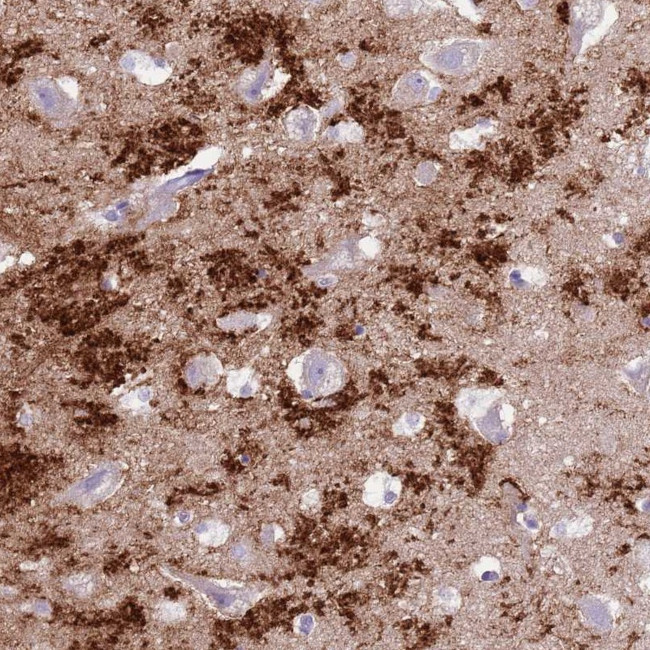 SLC7A14 Antibody in Immunohistochemistry (IHC)