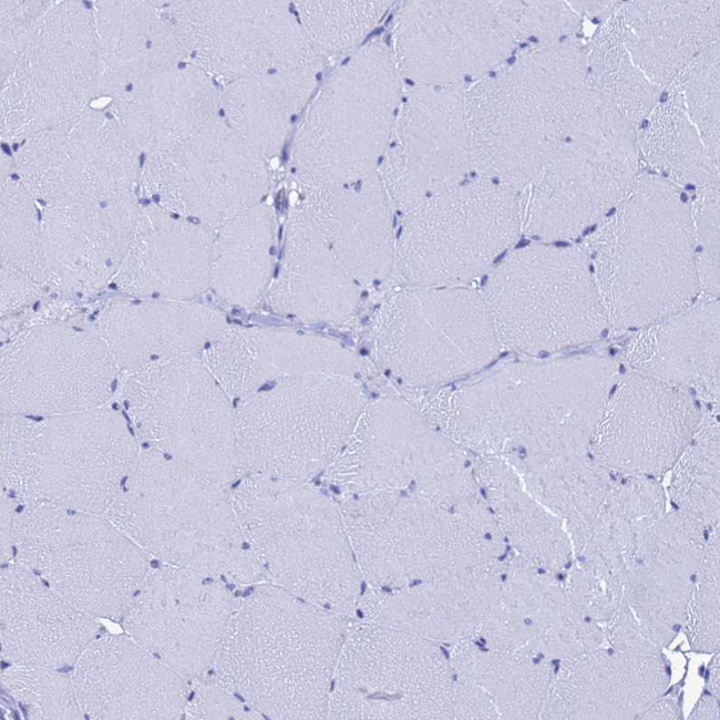 LIPF Antibody in Immunohistochemistry (Paraffin) (IHC (P))