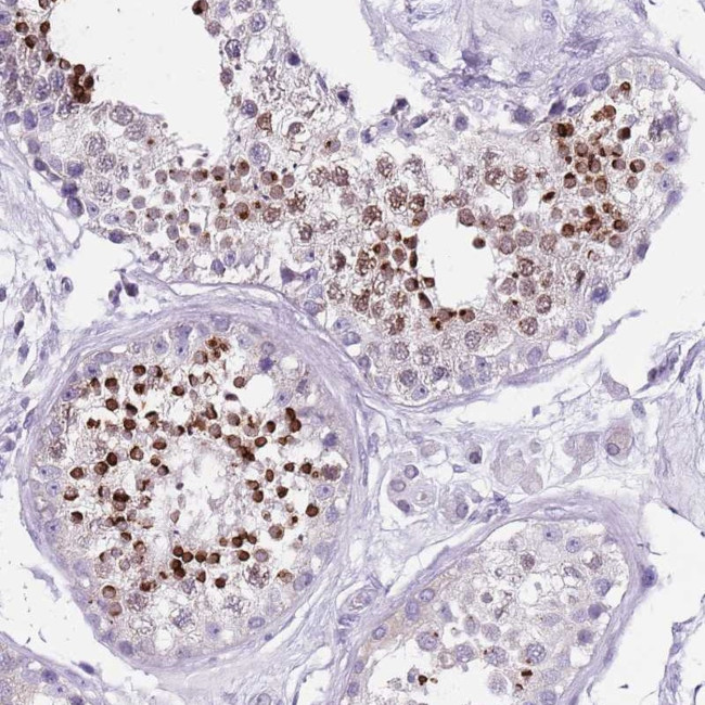 SPESP1 Antibody in Immunohistochemistry (Paraffin) (IHC (P))