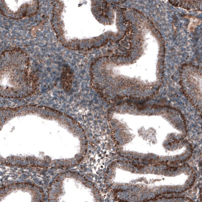 ZDHHC14 Antibody in Immunohistochemistry (IHC)