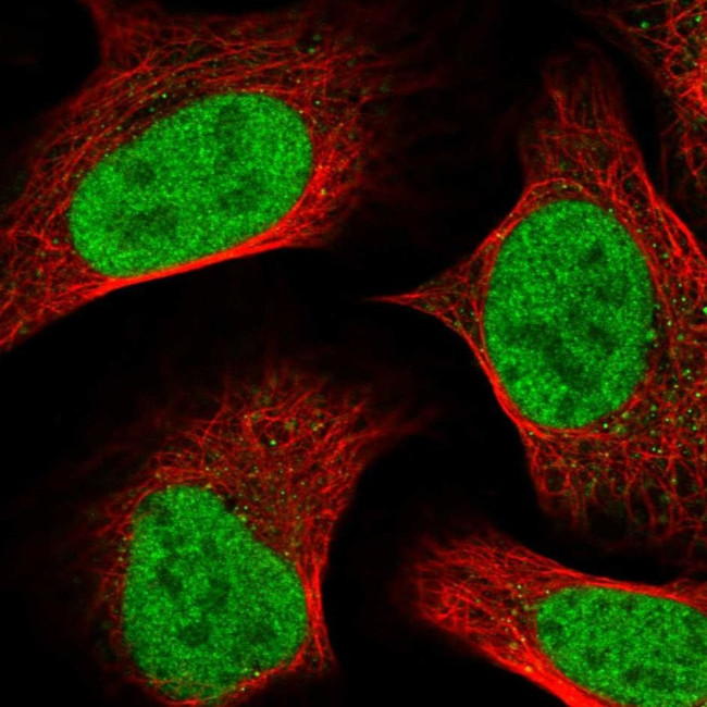 TM2D1 Antibody in Immunocytochemistry (ICC/IF)