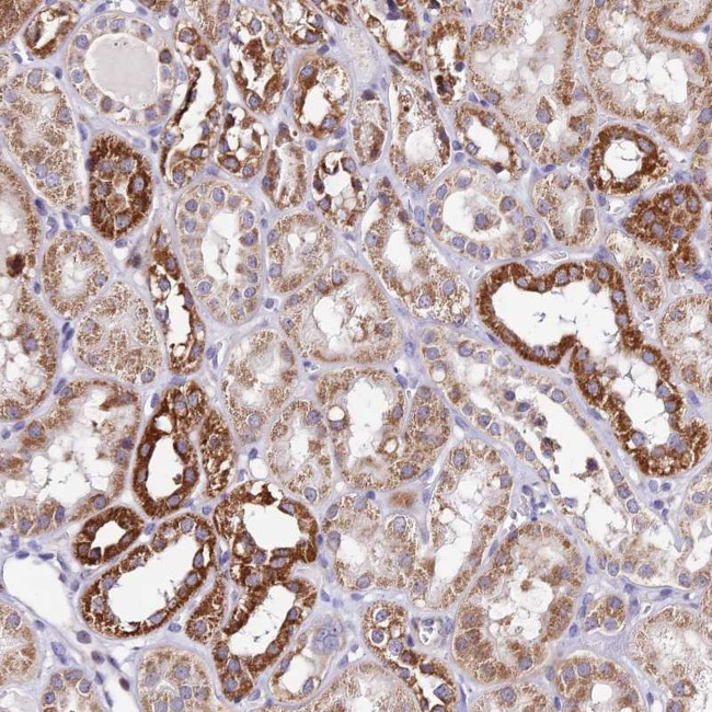ATP Synthase B1 Antibody in Immunohistochemistry (Paraffin) (IHC (P))