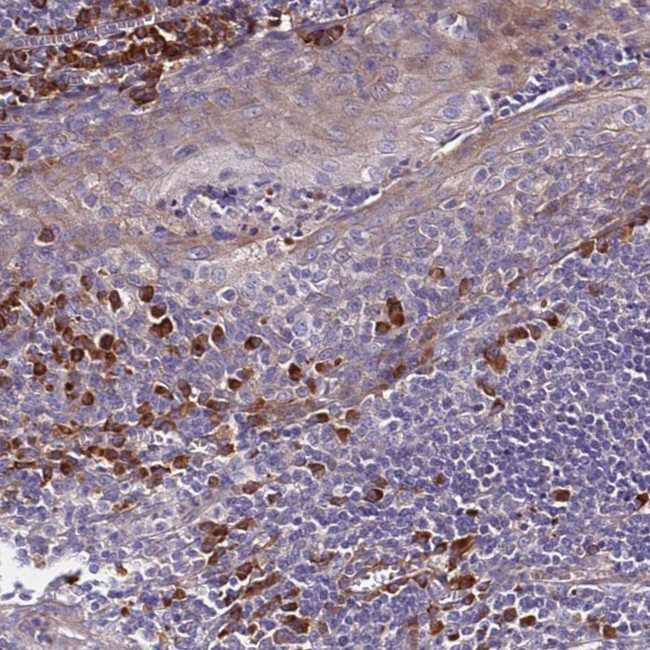 SPCS1 Antibody in Immunohistochemistry (IHC)