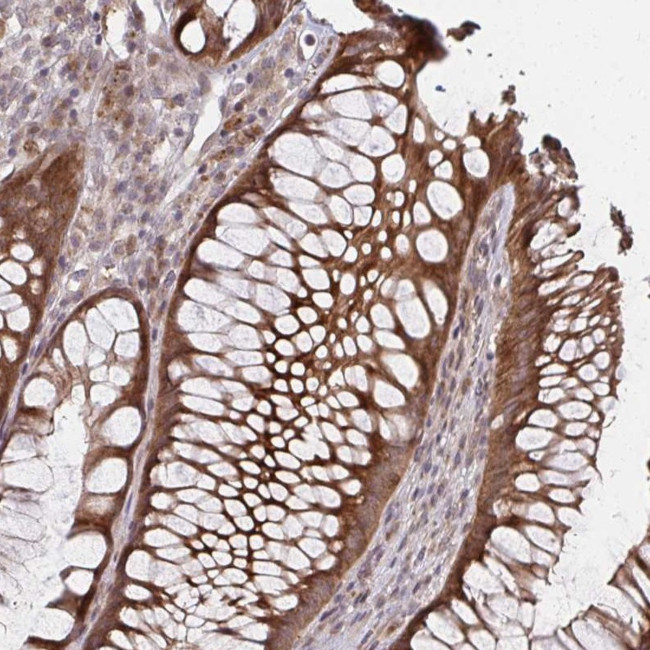 ZNF285 Antibody in Immunohistochemistry (Paraffin) (IHC (P))