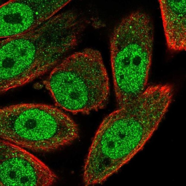 RNF181 Antibody in Immunocytochemistry (ICC/IF)
