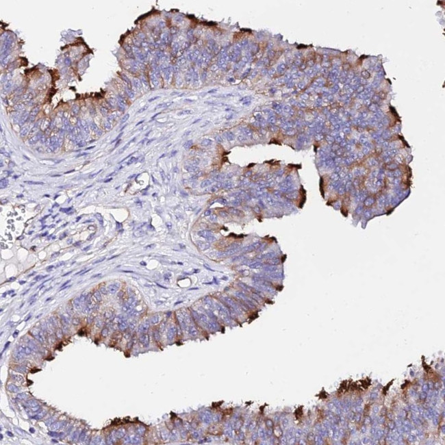 WDR69 Antibody in Immunohistochemistry (Paraffin) (IHC (P))