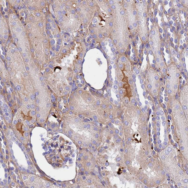 CRHBP Antibody in Immunohistochemistry (Paraffin) (IHC (P))