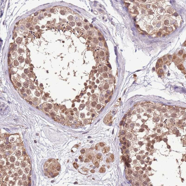 BBS5 Antibody in Immunohistochemistry (Paraffin) (IHC (P))