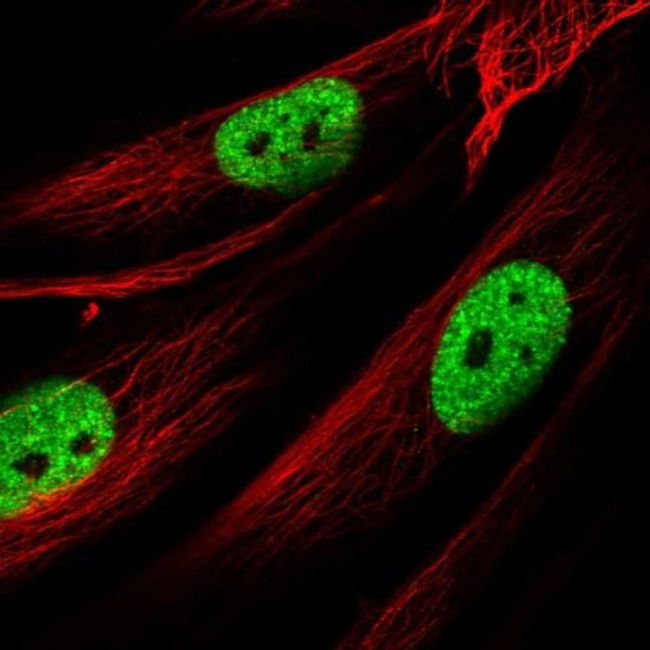 AMIGO1 Antibody in Immunocytochemistry (ICC/IF)