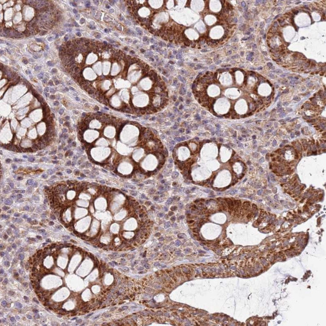 KIF25 Antibody in Immunohistochemistry (Paraffin) (IHC (P))