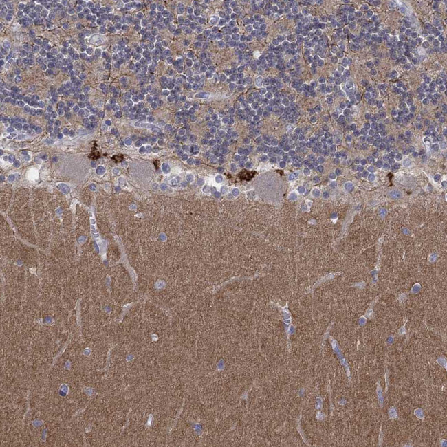 AMN1 Antibody in Immunohistochemistry (Paraffin) (IHC (P))