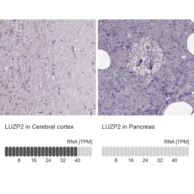LUZP2 Antibody in Immunohistochemistry (IHC)