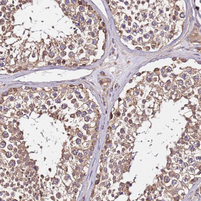 LRRIQ1 Antibody in Immunohistochemistry (Paraffin) (IHC (P))