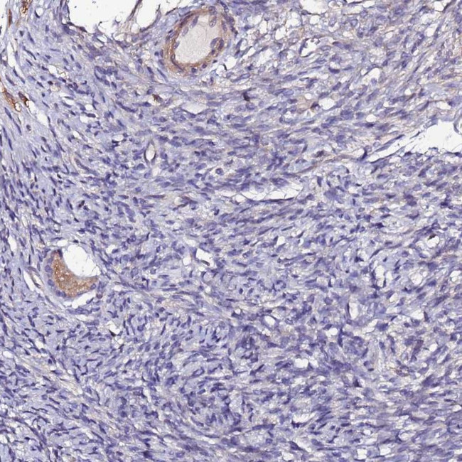 JRKL Antibody in Immunohistochemistry (Paraffin) (IHC (P))