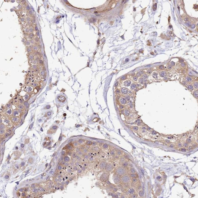 WDR64 Antibody in Immunohistochemistry (Paraffin) (IHC (P))
