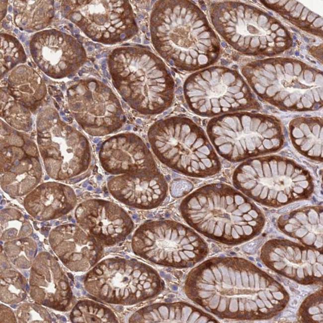 FOXRED1 Antibody in Immunohistochemistry (Paraffin) (IHC (P))