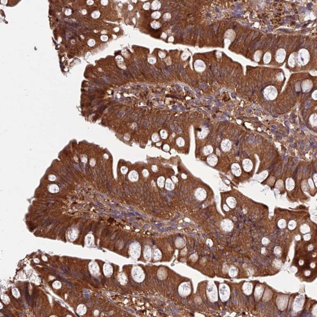 GRTP1 Antibody in Immunohistochemistry (Paraffin) (IHC (P))