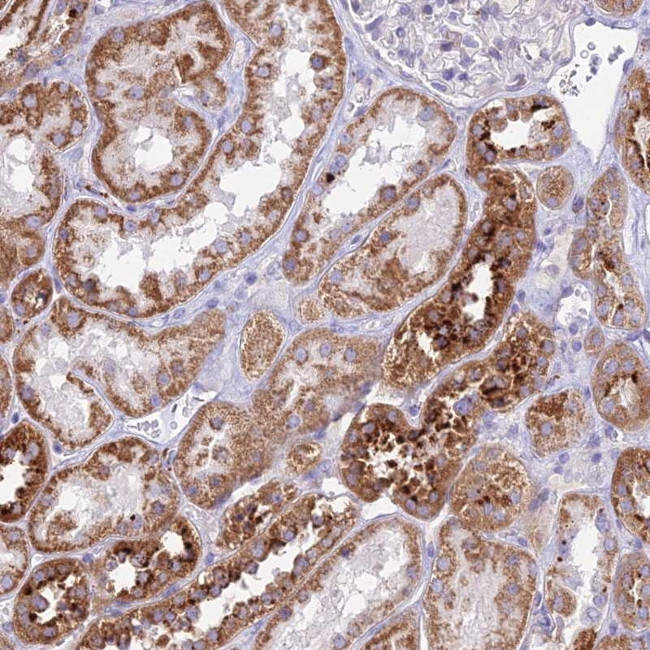 PNLIPRP3 Antibody in Immunohistochemistry (Paraffin) (IHC (P))