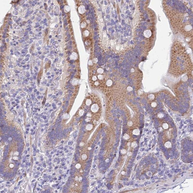 PRR13 Antibody in Immunohistochemistry (IHC)