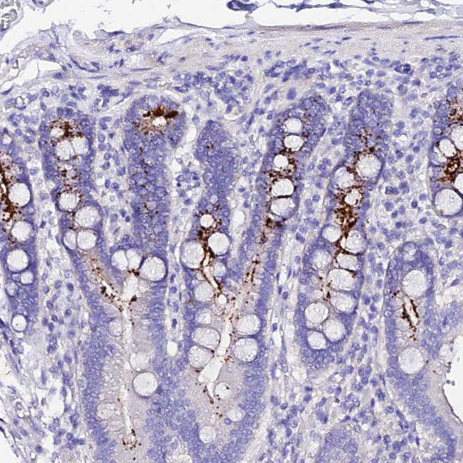 TMEM117 Antibody in Immunohistochemistry (Paraffin) (IHC (P))