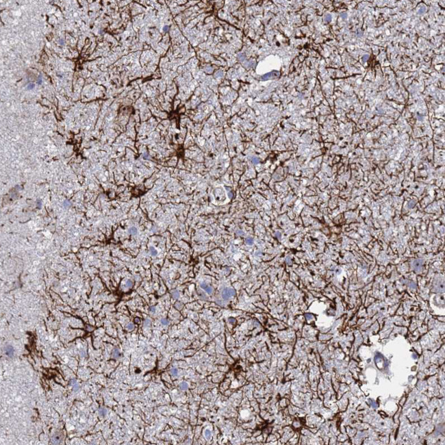 SYT13 Antibody in Immunohistochemistry (Paraffin) (IHC (P))