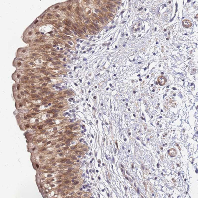 MTCL1 Antibody in Immunohistochemistry (Paraffin) (IHC (P))